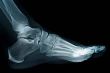 Digital Radiography digital x ray in the Palm Beach County, FL: Boynton Beach (Greenacres, Boca Del Mar, Lantana, Kings Point) and Wellington (Royal Palm Beach, Riviera Beach, Loxahatchee, Westgate) areas